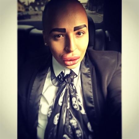 جنجال جراحی زیبایی پسری برای شبیه شدن به کیم کارداشیان! (تصاویر)